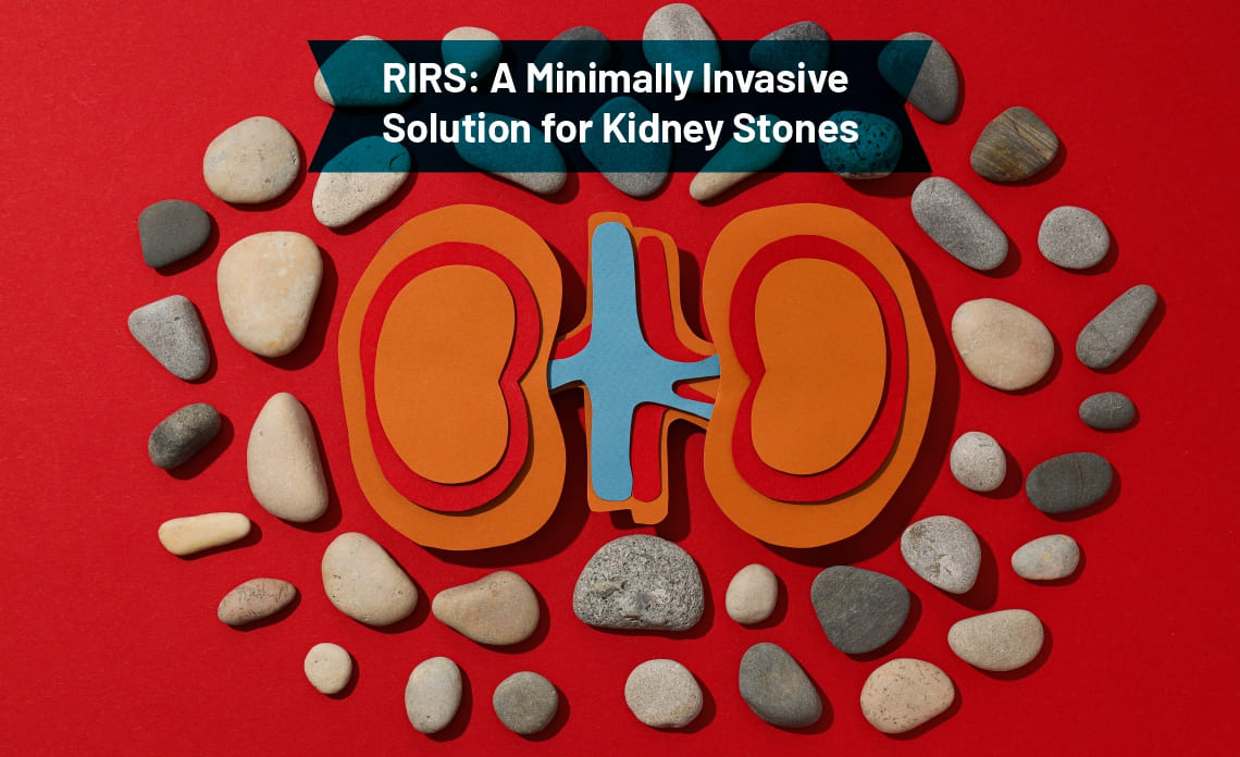 RIRS: A Minimally Invasive Solution for Kidney Stones
